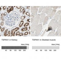 Anti-TSPAN1 antibody produced in rabbit 