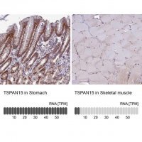 Anti-TSPAN15 antibody produced in rabbit 