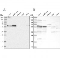 Anti-TSPYL1 antibody produced in rabbit 