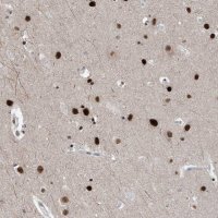 Anti-TSPYL1 antibody produced in rabbit 