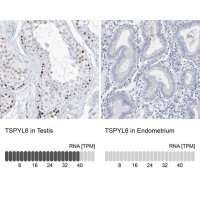 Anti-TSPYL6 antibody produced in rabbit 