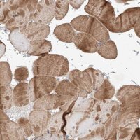 Anti-TSR2 antibody produced in rabbit 