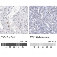 Anti-TSSK1B antibody produced in rabbit HPA027827-100UL