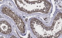 Anti-TSTA3 Antibody, clone 2N10-H1 ZooMAb� Rabbit Monoclonal 