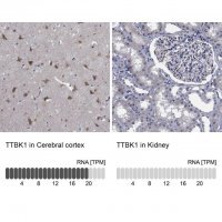 Anti-TTBK1 antibody produced in rabbit 