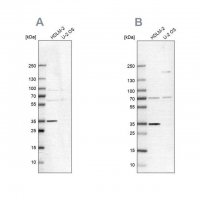 Anti-TTC19 antibody produced in rabbit 