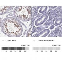Anti-TTC21A antibody produced in rabbit