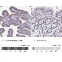 Anti-TTC26 antibody produced in rabbit
