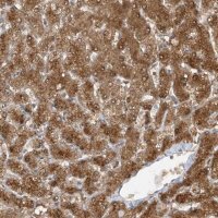 Anti-TTC38 antibody produced in rabbit