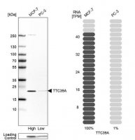 Anti-TTC39A antibody produced in rabbit 