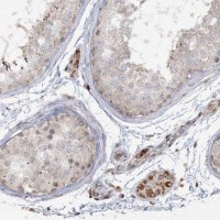 Anti-TTC7A antibody produced in rabbit