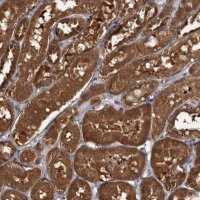 Anti-TTI2 antibody produced in rabbit 