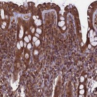 Anti-TTLL10 antibody produced in rabbit 