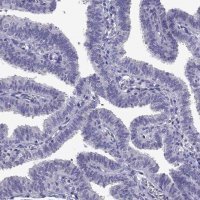 Anti-TTN antibody produced in rabbit