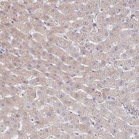 Anti-TTR antibody produced in rabbit HPA002550-100UL