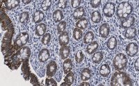 Anti-Tubulin -2 Antibody, clone 1M19 ZooMAb� Rabbit Monoclonal 