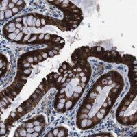 Anti-TULP3 antibody produced in rabbit HPA015285-100UL