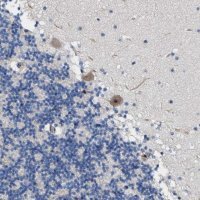 Anti-TWISTNB antibody produced in rabbit 