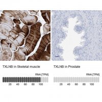 Anti-TXLNB antibody produced in rabbit 