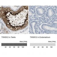 Anti-TXNDC2 antibody produced in rabbit 