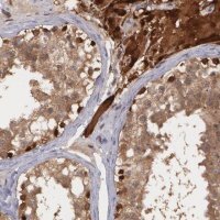 Anti-TXNRD1 antibody produced in rabbit 