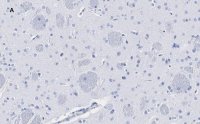 Anti-Tyrosine Hydroxylase Antibody, clone 3M12, ZooMAb� Rabbit Monoclonal 