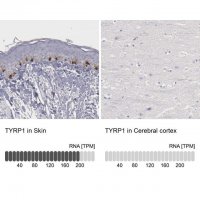 Anti-TYRP1 antibody produced in rabbit HPA000937-100UL