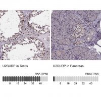 Anti-U2SURP antibody produced in rabbit 