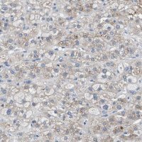 Anti-UAP1 antibody produced in rabbit 