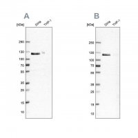 ANTI-UBA1 antibody produced in rabbit HPA000289-100UL