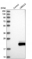 Anti-UBE2L6 antibody produced in rabbit