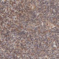 Anti-UBE2L6 antibody produced in rabbit