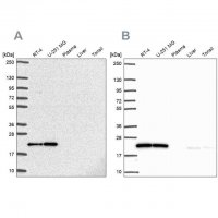 Anti-UBE2M antibody produced in rabbit HPA054551-100UL