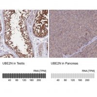 Anti-UBE2N antibody produced in rabbit
