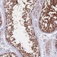 Anti-UBE2N antibody produced in rabbit