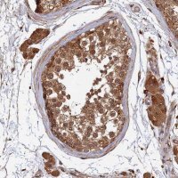Anti-UBE2W antibody produced in rabbit HPA045161-100UL