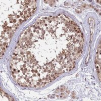 Anti-UBE3A antibody produced in rabbit