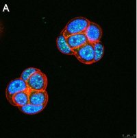 Anti-Ubiquilin 4 Antibody, clone 5K6 ZooMAb� Rabbit Monoclonal 
