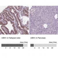 Anti-UBN1 antibody produced in rabbit 