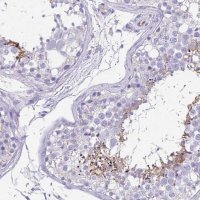 Anti-UBQLN3 antibody produced in rabbit