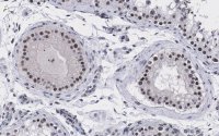 Anti-UBR5 Antibody, clone 2F14 ZooMAb� Rabbit Monoclonal 