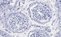 Anti-UBR5 Antibody, clone 2F14 ZooMAb® Rabbit Monoclonal