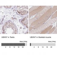 Anti-UBXN7 antibody produced in rabbit 