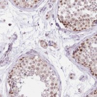 Anti-UBXN7 antibody produced in rabbit 