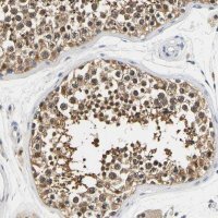 Anti-UCHL3 antibody produced in rabbit 