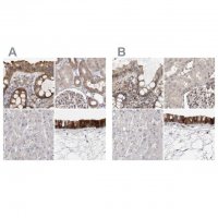 Anti-UFC1 antibody produced in rabbit 