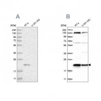 Anti-UFC1 antibody produced in rabbit 