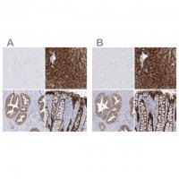 Anti-UGDH antibody produced in rabbit 