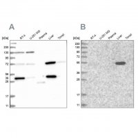 Anti-UGP2 antibody produced in rabbit HPA034697-100UL