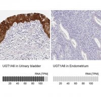 Anti-UGT1A6 antibody produced in rabbit 